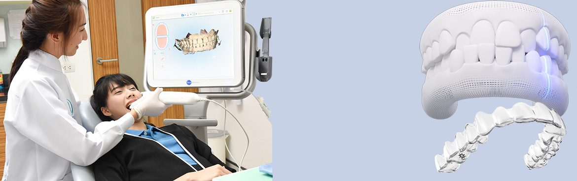 invisalign braces
